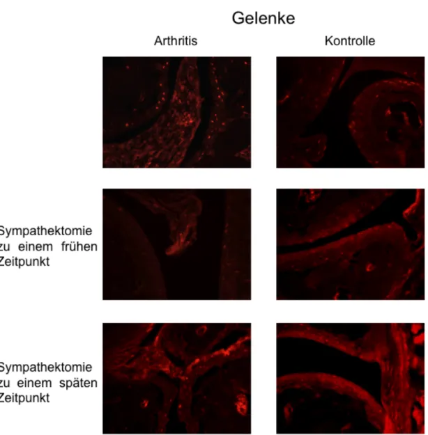 Abb.  7:  Repräsentative  Fluoreszenzfärbungen  Tyrosinhydroxylase-positiver  Zellen  in  Ge- Ge-lenken  von  Mäusepfoten