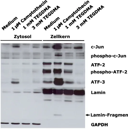 Abbildung 5: Der Einfluss von TEGDMA und Camptothecin auf die Expression von  c-Jun,  ATF-2  und  ATF-3  in  HeLa-Zellen