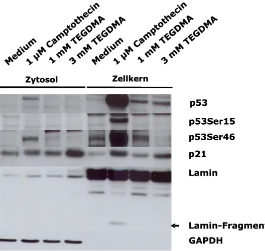 Abbildung 8: Der Einfluss von TEGDMA und Camptothecin auf die Aktivierung von  p53  und  p21  in  HeLa-Zellen