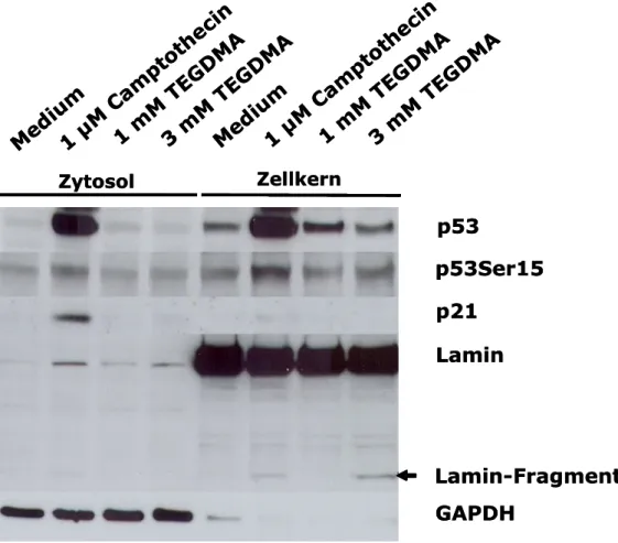 Abbildung  10:  Der  Einfluss  von  TEGDMA  und  Camptothecin  auf  die  Aktivierung  von  p53  und  p21  in  RAW264.7-Mausmakrophagen