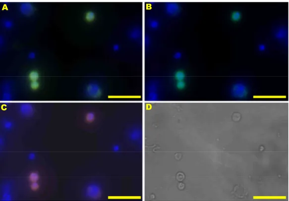 Abbildung  12:  Färbung  mit  EpIC  und  EpEX  auf  Haftobjektträger  (MCF-7):  Färbung  der  intrazellulären  und  extrazellulären  EpCAM-Domäne
