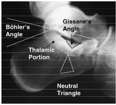 Abb. 4: Röntgenologische Darstellung der Rückfußanatomie im lateralen Strahlengang  [Rammelt &amp; Zwipp 2004] 