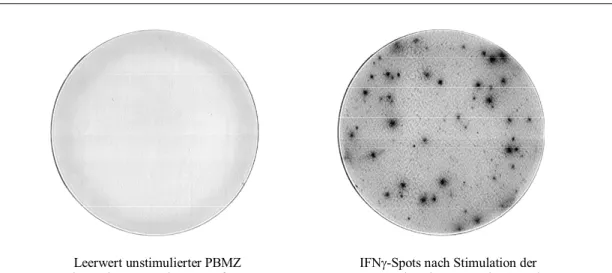 Abbildung 3  Kamerablick auf IFNγ-Spots spenderreaktiver Zellen im ELISpot-Assay 