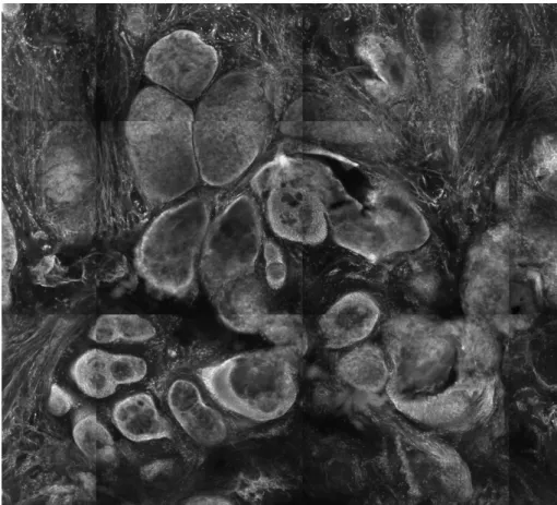 Abbildung 15: Detailansicht Drüsengewebe, Größe ca. 0,5 x 0,5 mm 
