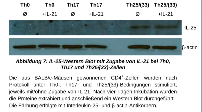 Abbildung 7: IL-25-Western Blot mit Zugabe von IL-21 bei Th0,  Th17 und Th25/(33)-Zellen 