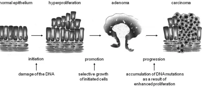 Figure 3: Schematic illustration of the adenoma-carcinoma sequence. [taken and  adapted from: 