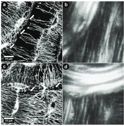 Figure 19: Magnification of area * and ** from Figure 18: the cement line disrupts the os- os-teocyte network (arrows), (a) orientation of canaliculi as well as bone lamellae shown in (b)  between the old and the remodeled bone is parallel; (c) canaliculi 