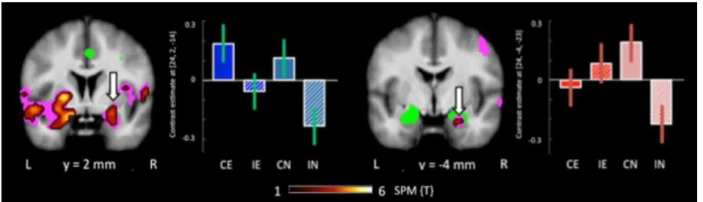 Figure 2. Brain responses: Effects of emotion and congruency in the right amygdala. Plots depict contrast  estimates for the respective peak voxel (+/- 90 percent confidence intervals)