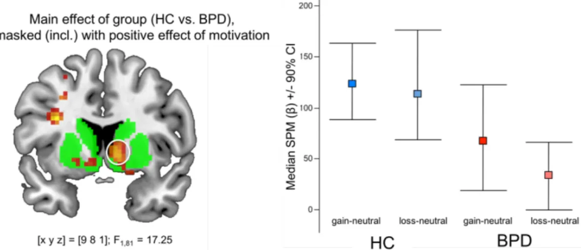 Figure 5. Effect of anticipation: Maximum of the ventral striatum, inclusively masked with the positive effect of  motivational salience