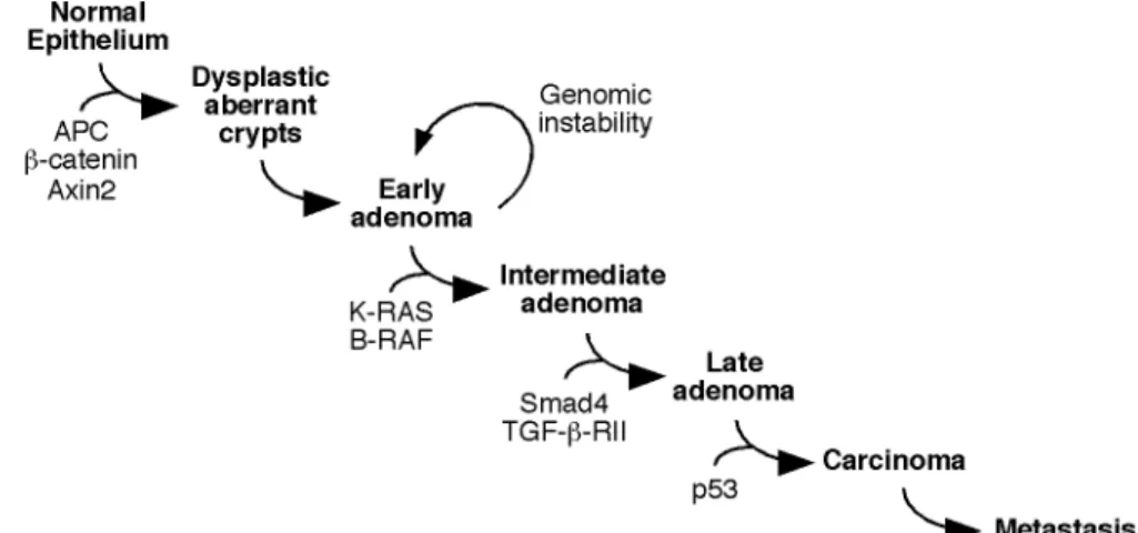 Fig.  3:  CRC  development.  Correlation  between  CRC  progression  and  the accumulation  of  genetic  alterations  according  to  Fearon  &amp;  Vogelstein  (1990) (Fearon and Vogelstein, 1990).