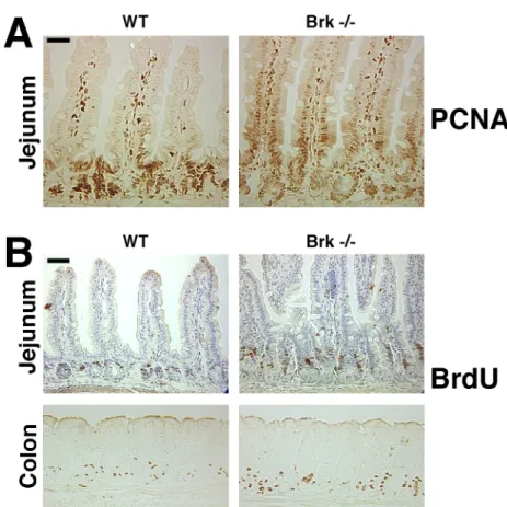 Fig. 6: Defects in intestinal epithelial homeostasis in the absence of Brk signaling.