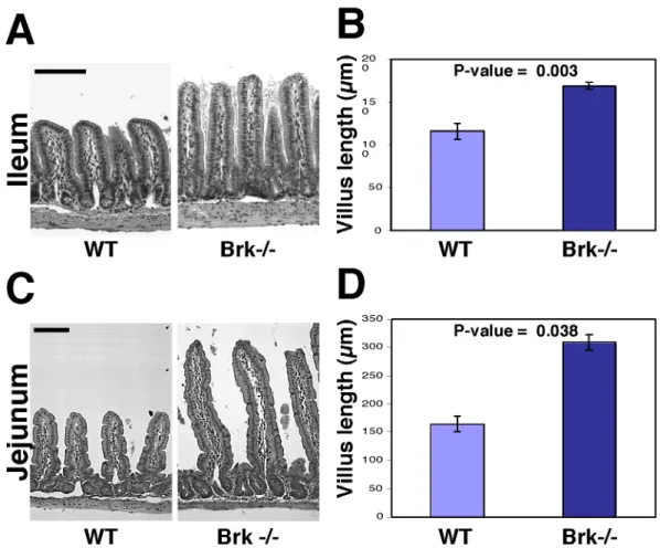Fig.  7:  Loss  of  Brk  expression  affects  the  crypt-villus  morphology.  (A,  C) Representative  sections  of  the  distal  ileum  and  distal  jejunum  from  wild-type (WT)  and  knockout  (Brk  -/-)  mice  stained  with  hematoxylin/eosin