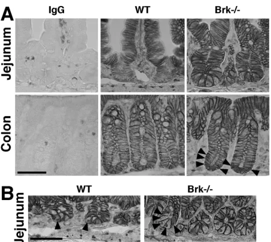Fig. 8: Increased nuclear  β-catenin expression in mutant intestinal epithelium.