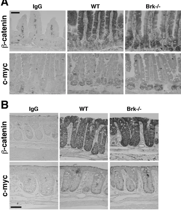 Fig.  9:  Expression  of  nuclear  β-catenin  and  its  target  gene  c-myc  in  mutant intestinal epithelium