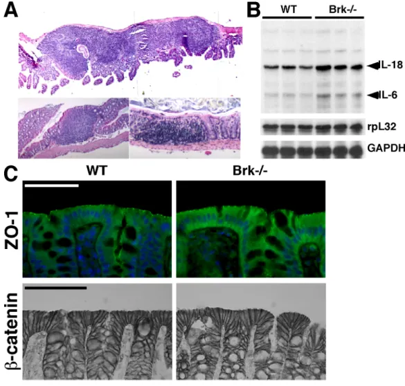 Fig. 11: Chronic inflammation in the intestinal epithelium of adult outbred Brk deficient mice (2.8)