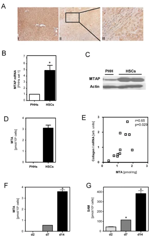 Figure 2.  MTAP expression and MTA levels in hepatocytes and hepatic stellate cells.  (A) Immunohistochemical analysis of MTAP in (I) control and (II,III) cirrhotic liver tissue (Magnification 200X and 400X)