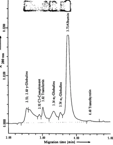 Fig. 6 Identification of gammopathies is possible both by capil- capil-lary electrophoresis and by agarose gel electrophoresis