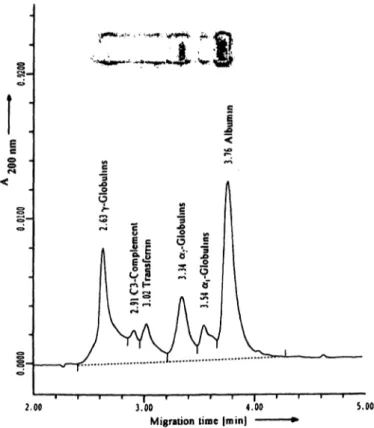 Fig. 7 Capillary electropherogram and agarose gel of a serum sample with a clear M-component.