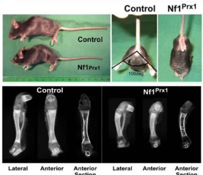 Figure 5: An Nf1 Prx1  mice model recapitulates the symptoms of NF1 patients. The upper panel shows the  smaller size and lack of ability of hind limb dispersion