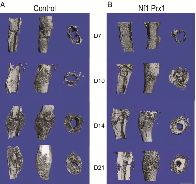 Figure  9: Comparison of Nf1 Prx1   mice  fracture callus with the control. µCT imaging evaluated callus  geometry and pattern