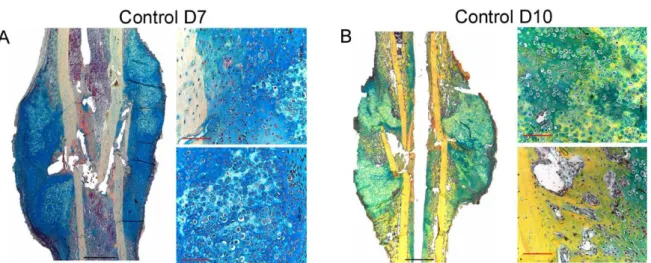 Figure 12: Movat pentachrome staining provides an overview of bone healing in fracture callus