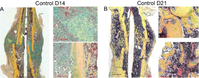 Figure 13: Movat pentachrome staining provides an overview of bone healing in fracture callus