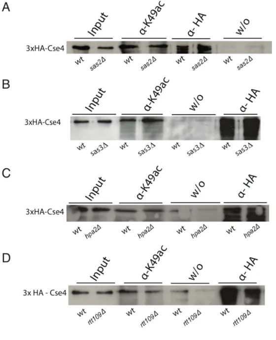 Figure 11: No influence of other histone acetyltransferases on Cse4K49 acetylation. 
