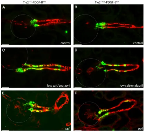 Figure 9. Immunohistochemical localization of renin-producing cells in Tie2 +/+ -PDGF-B fl/fl and Tie2 +/Cre -PDGF-B fl/fl mice