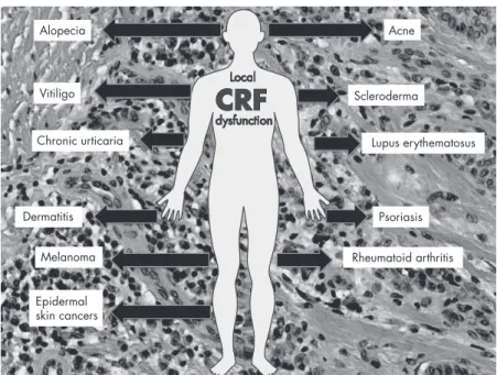 Figure 14. CRF and skin diseases. Several skin diseases are associated with CRF dysfunction