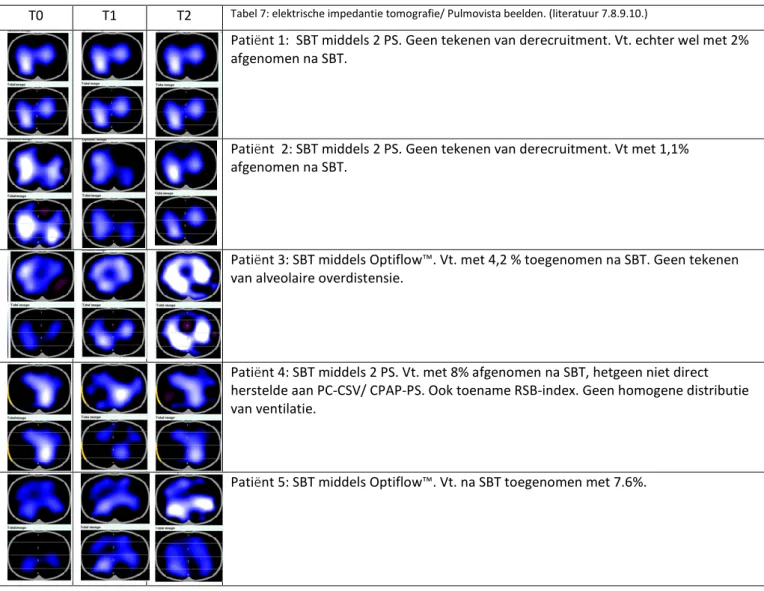 T0  T1  T2  Tabel 7: elektrische impedantie tomografie/ Pulmovista beelden. (literatuur 7.8.9.10.) 