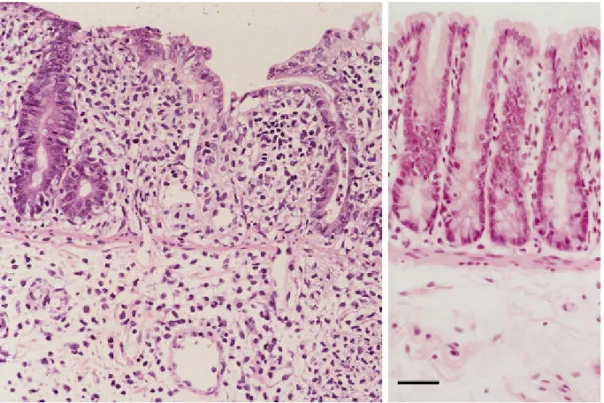 Figure 7. Left panel: destruction of crypts and diffuse epithelial flattening and erosion, massive mixed infiltration in (sub)mucosa of the caecum of a rat, infected with S