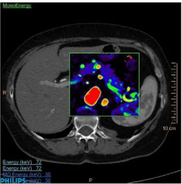 Figure 3: Image taken by a spectral CT scanner.  