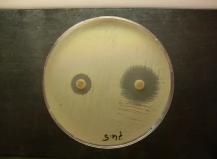 Figure 3 ESBL confirmation test using Sensi-Disc tm . Shown is a  cefotaxime-resistant E