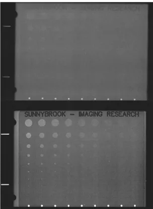 Figuur 7.3: Opnames van een contrast-detailfantoom met een conventionele (boven)  en een digitale  mammograaf (bron: NCRP) 