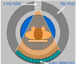 Figuur 2.1:  Schematische voorstelling van een patiënt in een CT-scanner (bron: ImPACT)