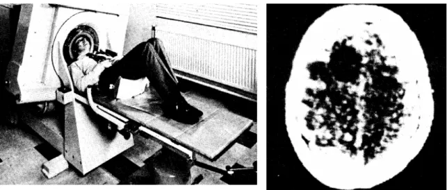Figuur 2.3:  De eerste commerciële scanner (links) en de eerste hersenscan met dit appa- appa-raat gemaakt (rechts) (bron: http://nobelprize.org/medicine/laureates/ 