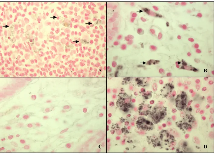 Figure 1. Immunoperoxidase staining for Map on paraffin sections of ileum from human (A- (A-B) and cow with Johne’s disease (D)