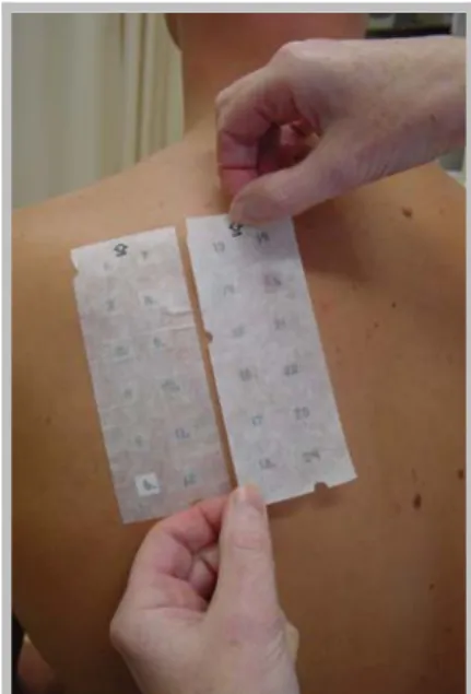 Figure 2: Application of a patch test  