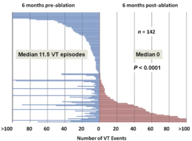 Figure 5 Plot showing the frequency of VT during the 6 months before (blue lines) and after (red lines) ablation for 142 patients with ICDs before and after ablation who survived 6 months (excluding patients with  inces-sant VT)
