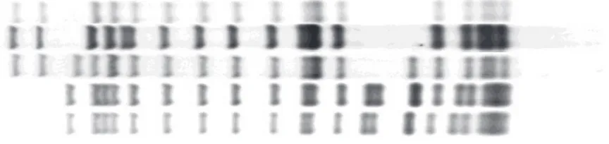Figuur 4.  Weergave van de resultaten van moleculaire typering van Mycobacterium tuberculosis  kweken met restrictie fragment lengte polymorfisme (RFLP) typering