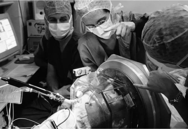 Figuur 2: Chirurgen plaatsen elektrodes voor diepe hersenstimulatie bij Parkinson patient