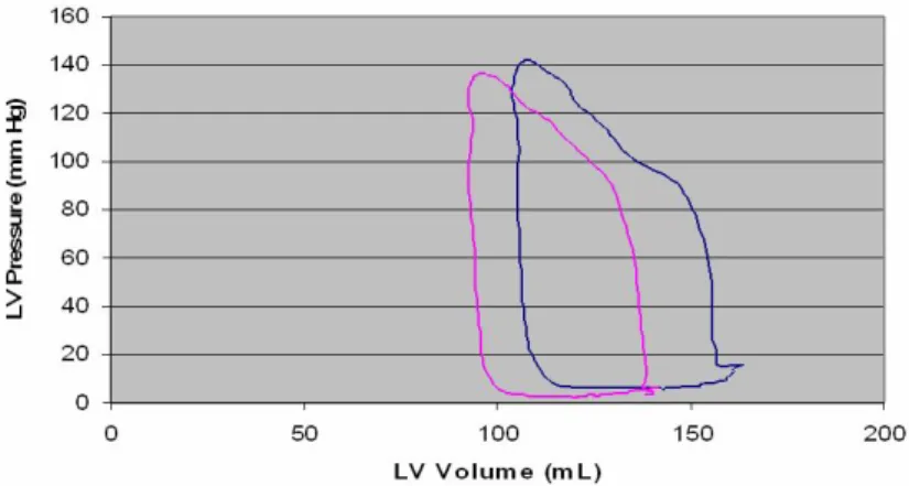 Figure 11: PV loop of the heart of a patient with coronary artery disease, with and without a pump (Measurements provided by AMC).
