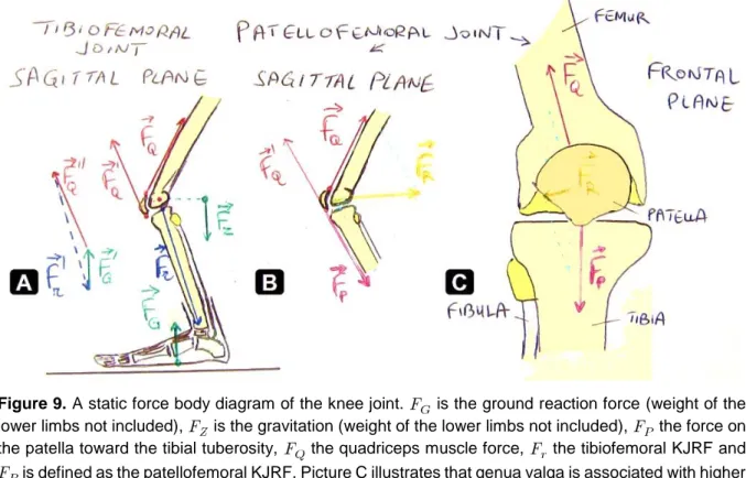 Figure 9. A static force body diagram of the knee joint.   is the ground reaction force (weight of the  lower limbs not included),   is the gravitation (weight of the lower limbs not included),   the force on  the patella toward the tibial tuberosity,   th