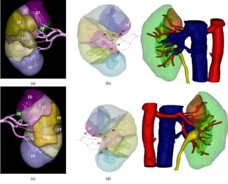 Figure 14: Comparison of the  Visible Patient© tool (left) and  the tool from this study  (middle) and the 3D model as  segmented by M