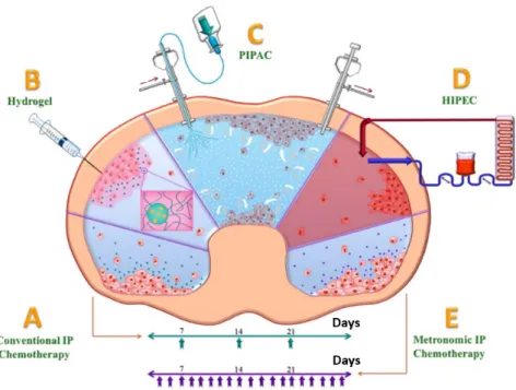 Figure 3.1: Schematic illustration of the different nanomedicine based intraperitoneal therapies.