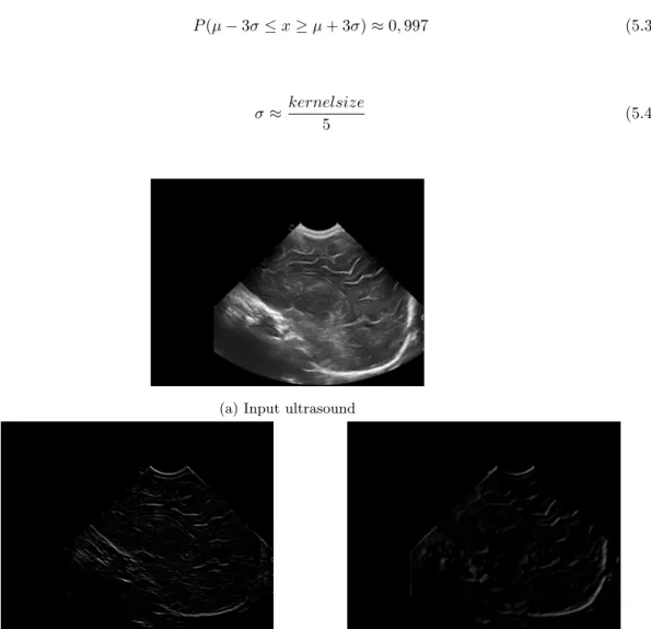 Figure 5.2: Results DoG and LoG filters on example ultrasound