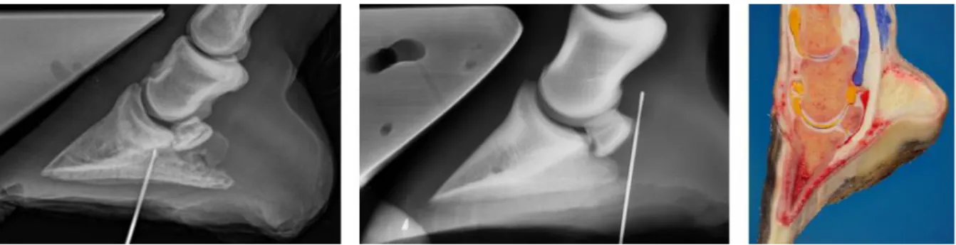 Figuur 13: Afbeeldingen links en midden: röntgenfoto's van nageltred met een sonde. Afbeelding rechts: doorsnede van een  hoef  waarvan  het  hoefgewricht  (geel),  kroongewricht  (geel),  bursa  podotrochlearis  (rood)  en  peesschede  (blauw)  zijn  aang