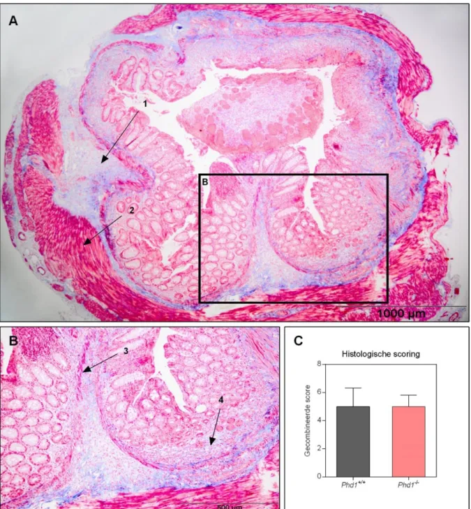 Figuur  4A: Transversale doorsnede onder Masson’s Trichroom kleuring (MTS) van het distale colon  van  een  Phd1  wildtype  muis  na  chronische  DSS  blootstelling,  40x  vergroot