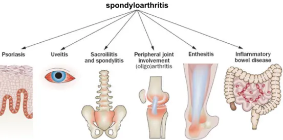 Figuur 11: mogelijke klinische manifestaties van spondyloartritis (31).  