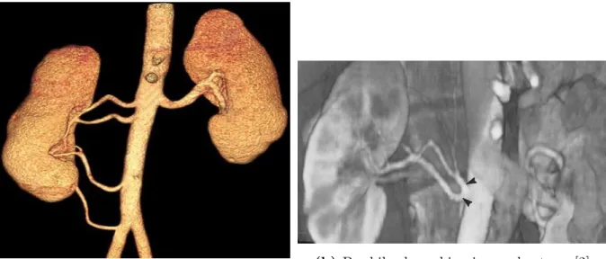 Figure 2.7 shows some examples of variations in the arterial anatomy of kidneys.